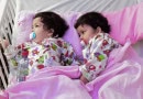 Pakistans Formerly Conjoined Sisters Attend International Conference On Conjoined Twins In Saudi Arabia
