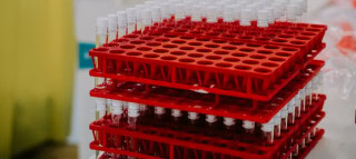 Cjc 1295 And Ghrp 2 Peptide Blend In Research And Beyond