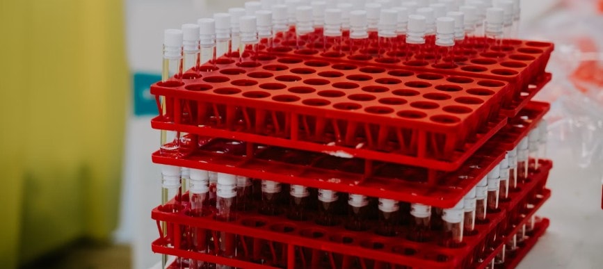 Cjc 1295 And Ghrp 2 Peptide Blend In Research And Beyond