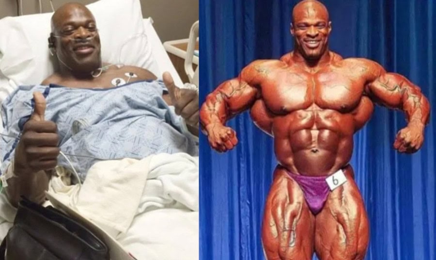 Is Ronnie Coleman Hospitalized After Heart Attack Full Details Here